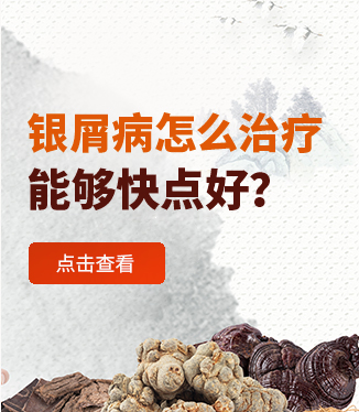 銀屑病怎么治療能夠快點好？