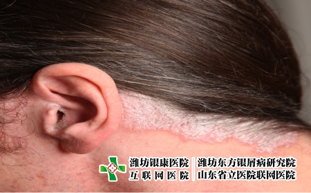 攝圖網_327944169_耳部和頸部的psorp絲蟲病（企業商用）