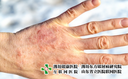 攝圖網_305177811_詳細縫合干成熟女手照護和皮膚病癥概念詳細縫合干成熟女手（企業商用）