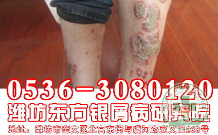放飛夢想  重獲新生